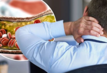 How High Cholesterol Affects the Brain: 9 Symptoms You Shouldn’t Ignore